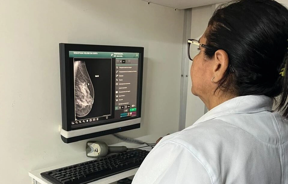Prevenção do câncer de mama: confira o passo a passo para fazer mamografia gratuita pelo SUS no Piauí